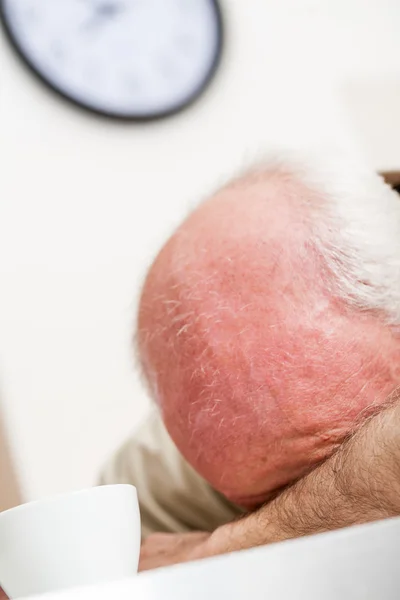 Лоб на руке спящего пожилого человека — стоковое фото