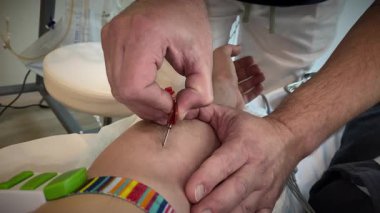 Phlebotomist İğneyi Kol 'a Yerleştiriyor, Kapalı Eller Tüpü ve Turnike, Steril Eldiven