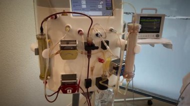 Ekran, Dokunmatik Ekran Görüntüleme Parametreleri, Bağlı Tüplü Görüntü Makinesi Konsolu. Kan arıtma yöntemi