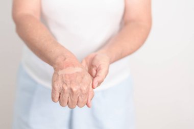 Karpal Tünel Sendromu, Bilek Tendiniti, kas ağrısı, De Quervain 's tenosynovitis, El Osteoartriti ve Kıdemli Sağlık Sendromu için bilek ağrısı çeken yaşlı kadın. 
