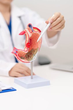 Gastrik anatomi modeli olan bir doktor. Gastroenterolog konsültasyonu, mide hastalıkları ve ülser, Kasım ayında mide kanseri, Gastroözofageal Reflü Hastalığı, GERD, Asit reflü ve sağlık hizmetleri
