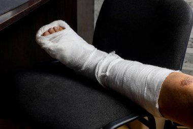 Kemik kırıldıktan sonra bandajlı bacak.