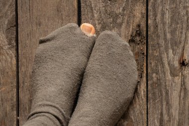 Bir kadının ayak parmağı evin zemininde yırtık bir çorabın içinden çıktı.