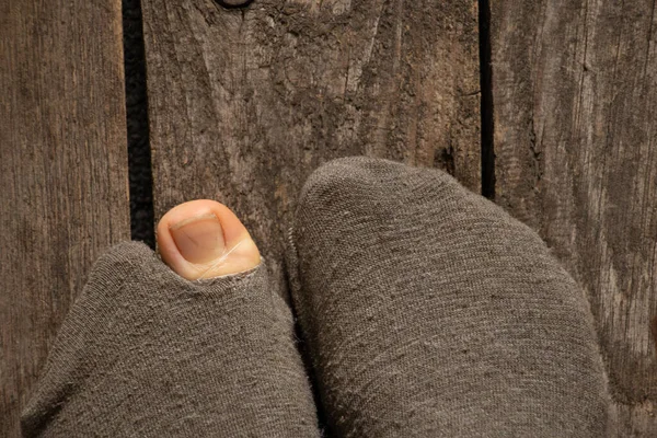 Roztrhané Ponožky Podlaze Domu Vylezl Ženský Prst Ženské Nohy Podlaze — Stock fotografie