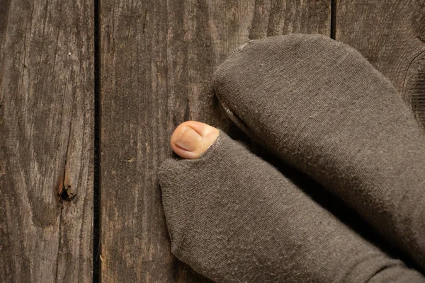 Egy Lábujja Kijött Egy Szakadt Zokniból Ház Padlóján Közelkép Női — Stock Fotó