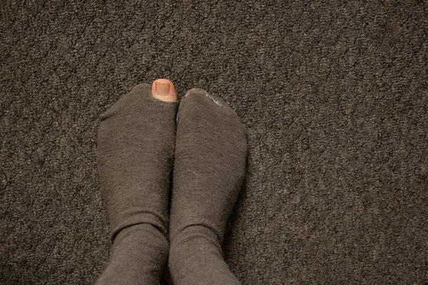 Ένα Γυναικείο Δάχτυλο Βγήκε Από Μια Σκισμένη Κάλτσα Στο Πάτωμα — Φωτογραφία Αρχείου