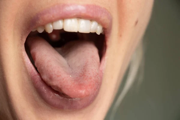 Open Mouth Tongue Lips Young Girl Close — Stock Photo, Image