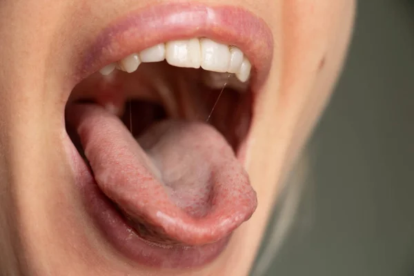 Boca Abierta Lengua Labios Una Chica Joven Cerca — Foto de Stock