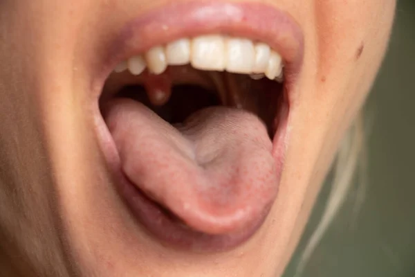 Boca Abierta Lengua Labios Una Chica Joven Cerca — Foto de Stock