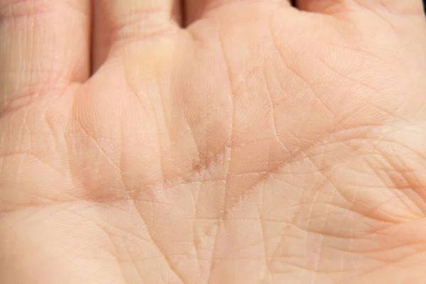 Hand Young Girl Background Macro Photo Part Body Close — Stock Photo, Image