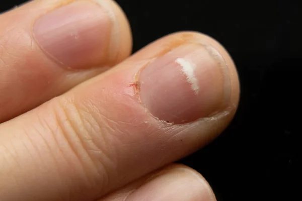 Hand Young Girl Background Macro Photo Part Body Close — Stock Photo, Image