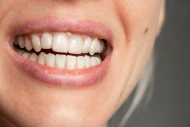 Ağzını aç ve dişlerini kapat, gülümse.