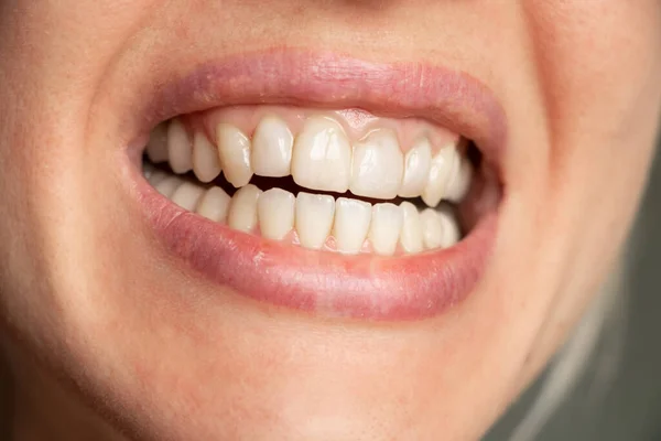 open mouth and female teeth close up, smile