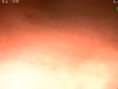 Karın ağrısı olan hastaya biyopsi yaparak gastroskopi yapmak bir hastanın gastrointestinal bölgesini fotoğraflamak.