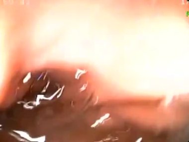 Karın ağrısı olan hastaya biyopsi yaparak gastroskopi yapmak bir hastanın gastrointestinal bölgesini fotoğraflamak.