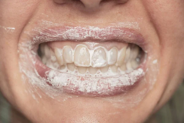 Dientes Femeninos Pasta Dientes Cepillarse Los Dientes Cerca — Foto de Stock