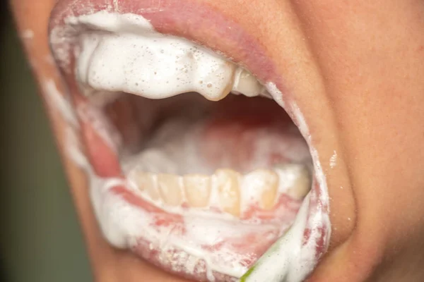 Dientes Femeninos Pasta Dientes Cepillarse Los Dientes Cerca — Foto de Stock