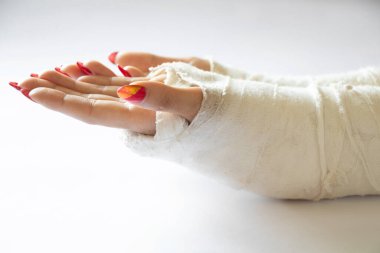 İzole bir arka planda alçıda bisikletten düştükten sonra bilekleri kırık iki kadın eli, alçıda eller.