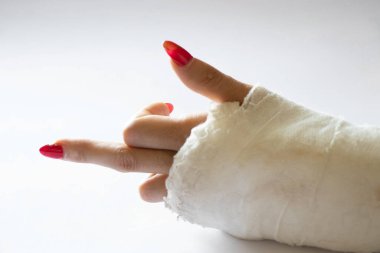 İzole bir arka planda alçıda bisikletten düştükten sonra bilekleri kırık iki kadın eli, alçıda eller.