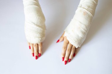 İzole bir arka planda alçıda bisikletten düştükten sonra bilekleri kırık iki kadın eli, alçıda eller.