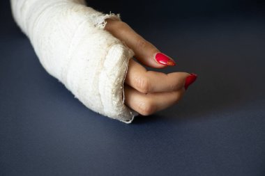 İzole bir arka planda alçıda bisikletten düştükten sonra bilekleri kırık iki kadın eli, alçıda eller.