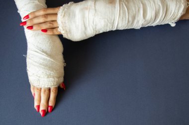 İzole bir arka planda alçıda bisikletten düştükten sonra bilekleri kırık iki kadın eli, alçıda eller.