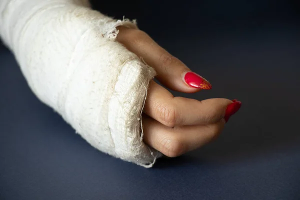 Two Female Hands Broken Wrists Falling Bicycle Cast Isolated Background — 图库照片