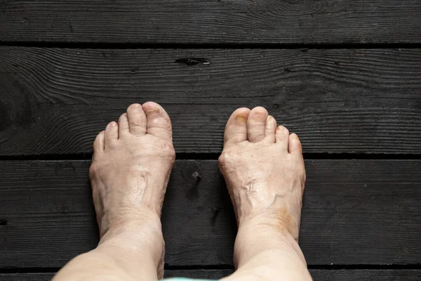 Staré Ženské Nohy Černé Dřevěné Podlaze Nohy Podlaze Staré Babičky — Stock fotografie