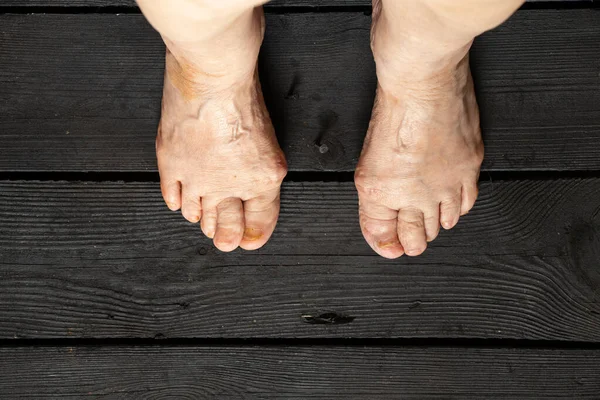 old female feet on black wooden floor, feet on the floor of an old grandmother