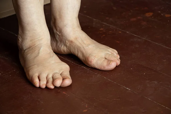 Nohy Staré Babičky Špinavé Dřevěné Podlaze Osamělost Nohy Starého Muže — Stock fotografie