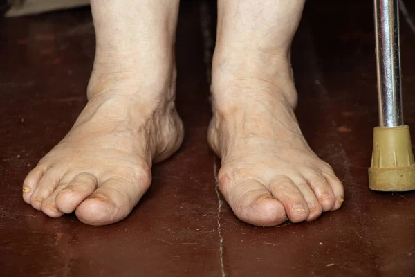 Nohy Staré Babičky Špinavé Dřevěné Podlaze Osamělost Nohy Starého Muže — Stock fotografie