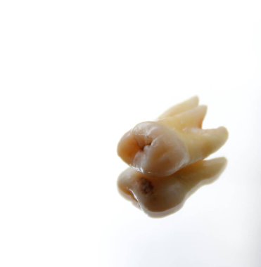             Yirmilik diş masada.