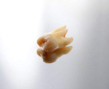             Yirmilik diş masada.