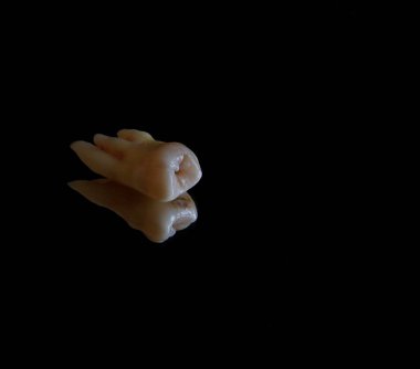             Yirmilik diş masada.