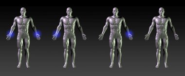 Wrist recovery or rehabilitation