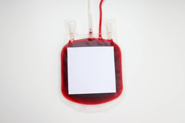 Beyaz bir yüzey üzerinde kırmızı sıvıyla dolu kan bağış torbası.