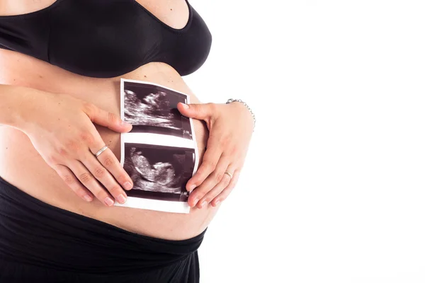 Echografie van een foetus — Stockfoto