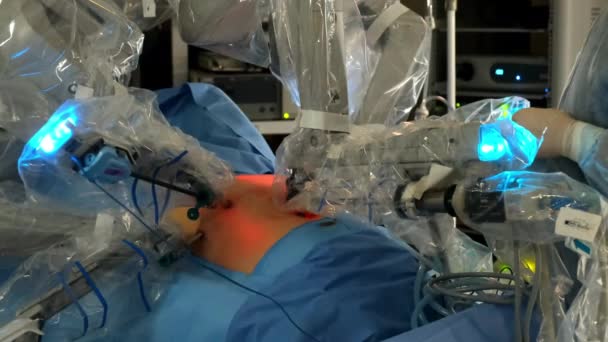 Equipamento Robótico Inovador Cirurgia Robô Cirúrgico Moderno Durante Trabalho — Vídeo de Stock