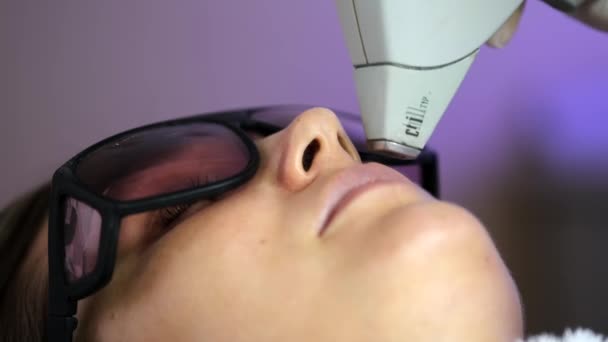 La procédure d'épilation au laser est l'épilation au-dessus de la lèvre supérieure d'une femme dans un salon de beauté. Impulsions laser. Soins du corps. Cosmétologie, épilation et concept de spa. — Video