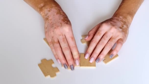 La maladie du vitiligo dans les mains d'une jeune fille. dépigmentation des zones cutanées. Gros plan d'une femme qui monte un puzzle en bois. — Video