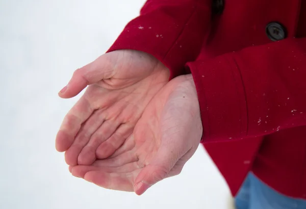 Ziekte van Raynaud — Stockfoto