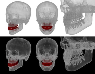 Diş Medikal illüstrasyon