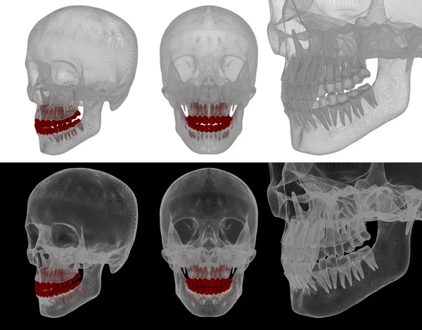 Ilustração médica do dente — Fotografia de Stock