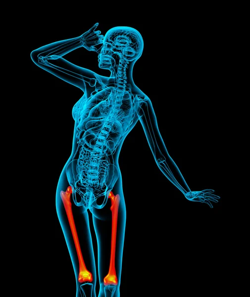 3d 渲染医学插图的股骨颈骨 — 图库照片