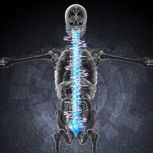 3D Darstellung des schmerzhaften Rückens — Stockfoto