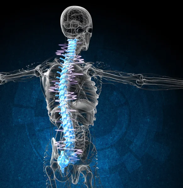 3D render ilustracja medyczny bolesne tylnej — Zdjęcie stockowe