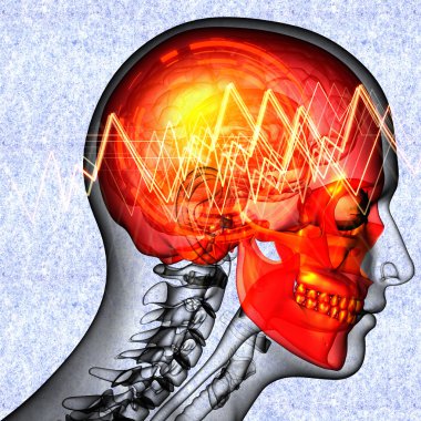 baş ağrısına 3D render tıbbi çizimi