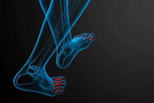 3D-Darstellung medizinischer Illustration des Fußes der Phalangen — Stockfoto