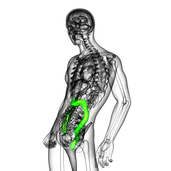 3d 渲染医学插图的人类大肠癌 — 图库照片