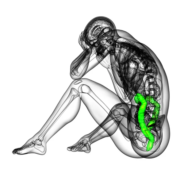 3d 渲染医学插图的人类大肠癌 — 图库照片